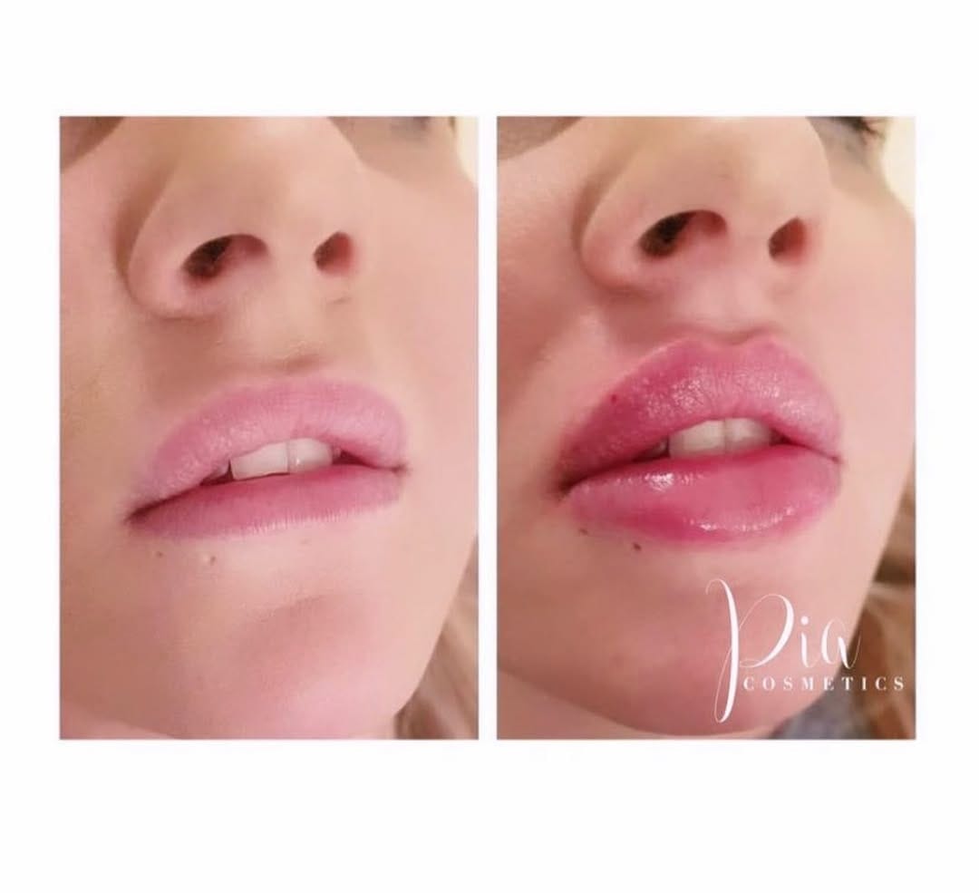 Post 7 by Aesthetics & Beauty By Pia 💋 on Instagram (image)