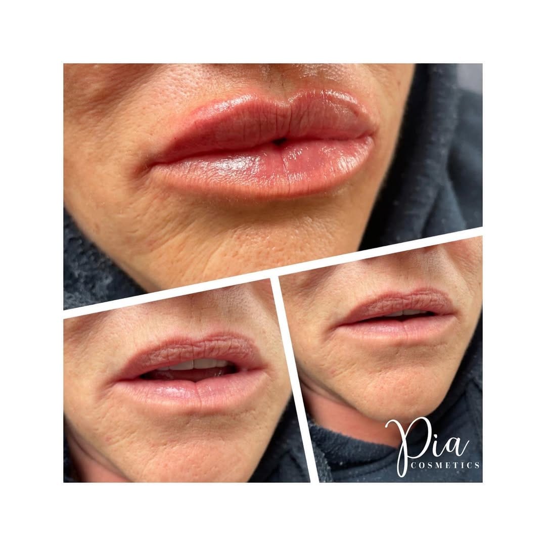 Post 5 by Aesthetics & Beauty By Pia 💋 on Instagram (image)