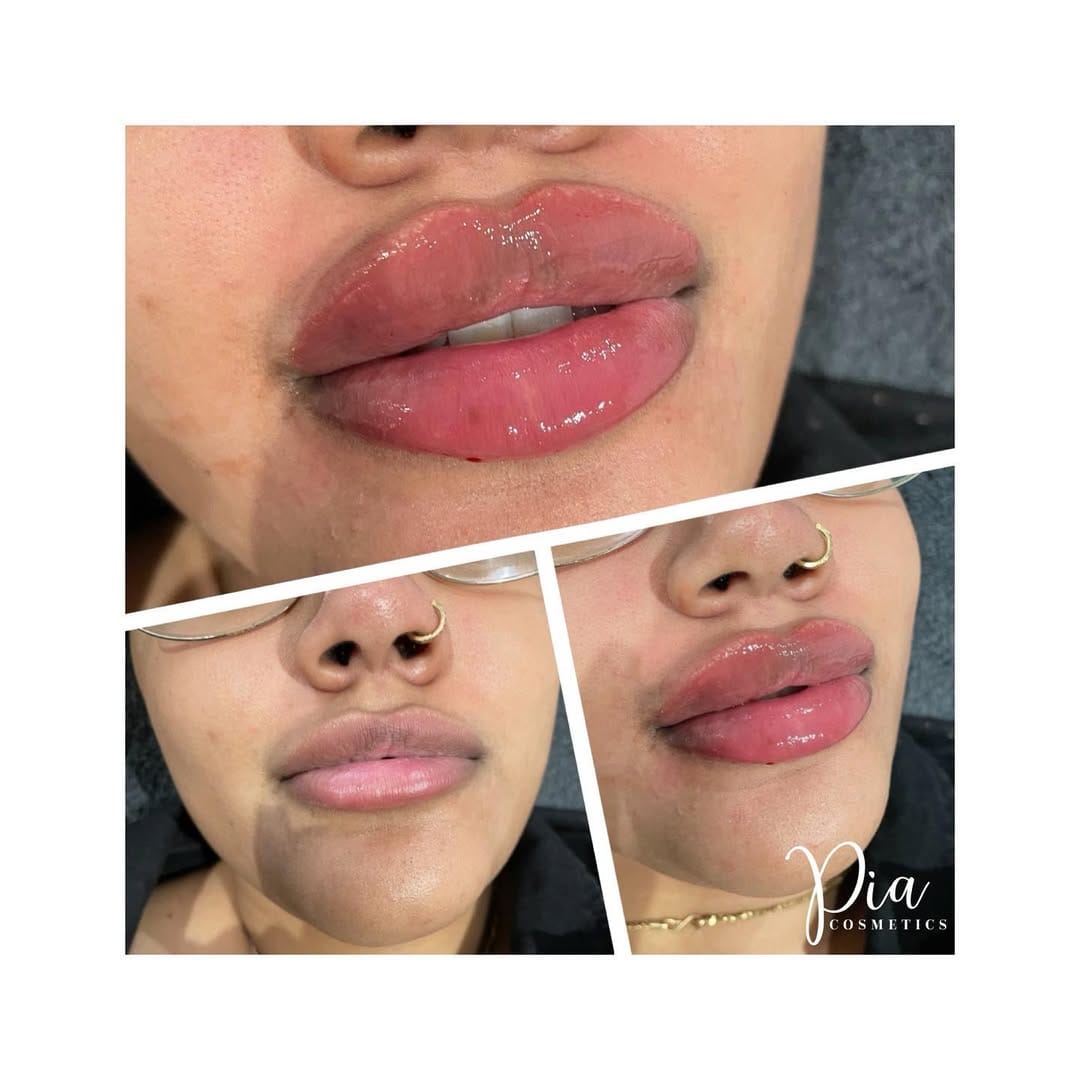 Post 8 by Aesthetics & Beauty By Pia 💋 on Instagram (image)