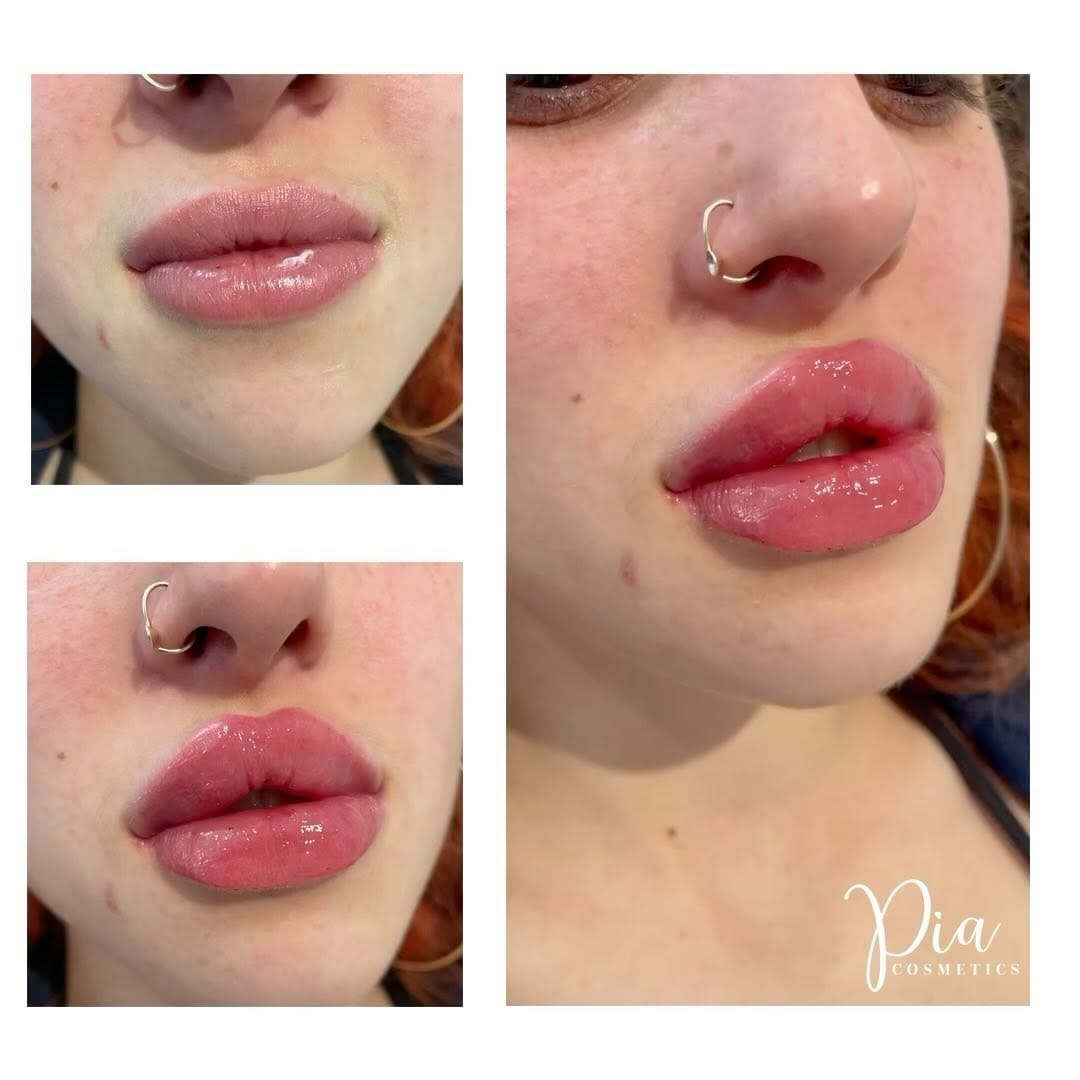 Post 1 by Aesthetics & Beauty By Pia 💋 on Instagram (video)