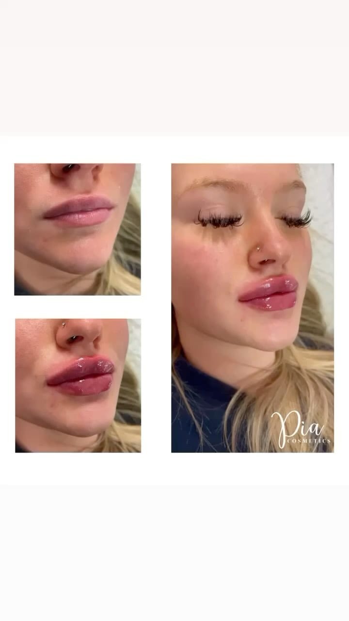 Post 2 by Aesthetics & Beauty By Pia 💋 on Instagram (video)
