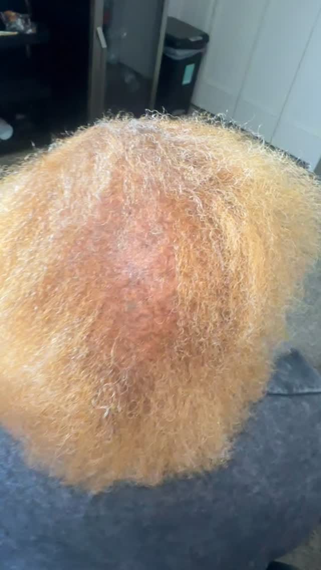 Post 7 by Alopecia Braider on Instagram (video)