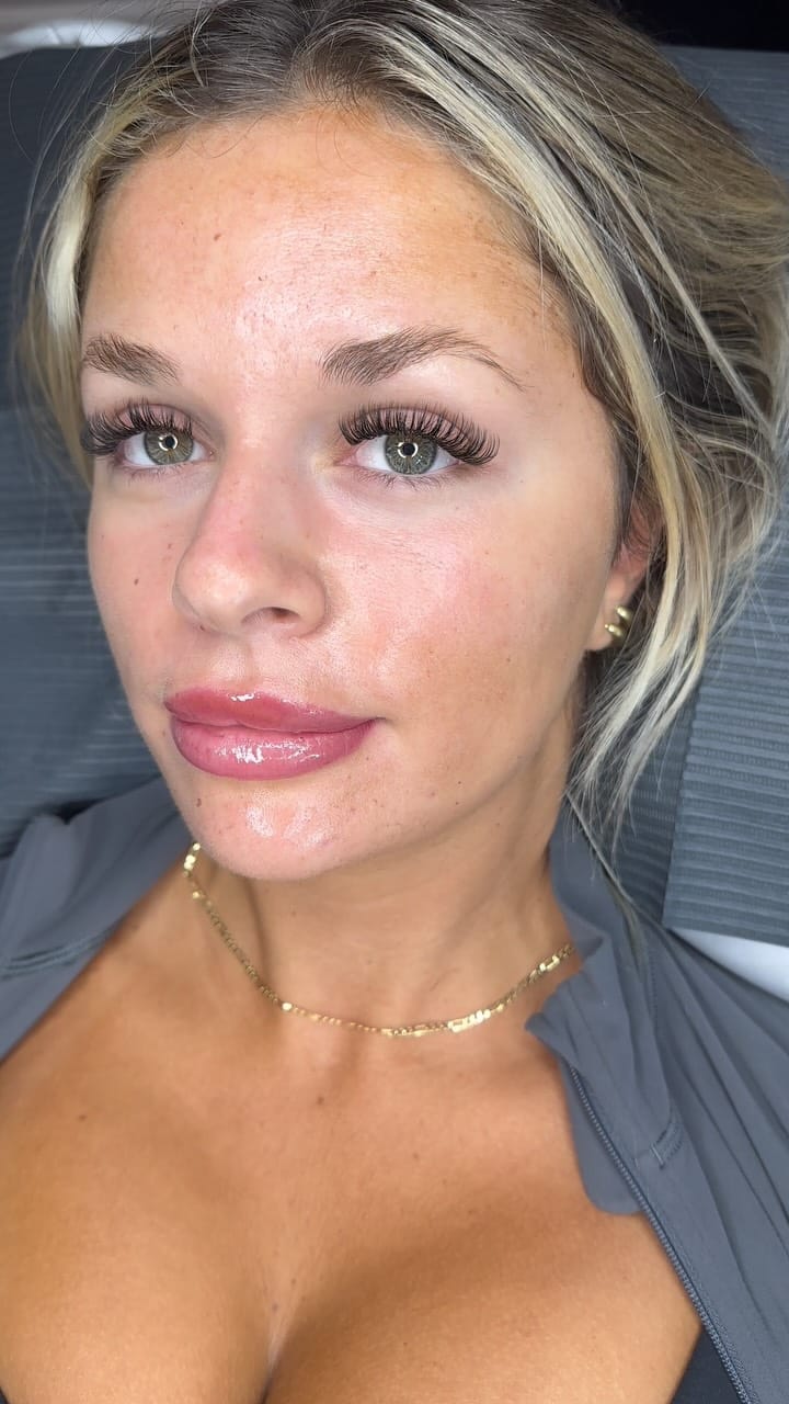 Post 7 by Vena | Nurse • Esthetician • Lash Tech on Instagram (video)
