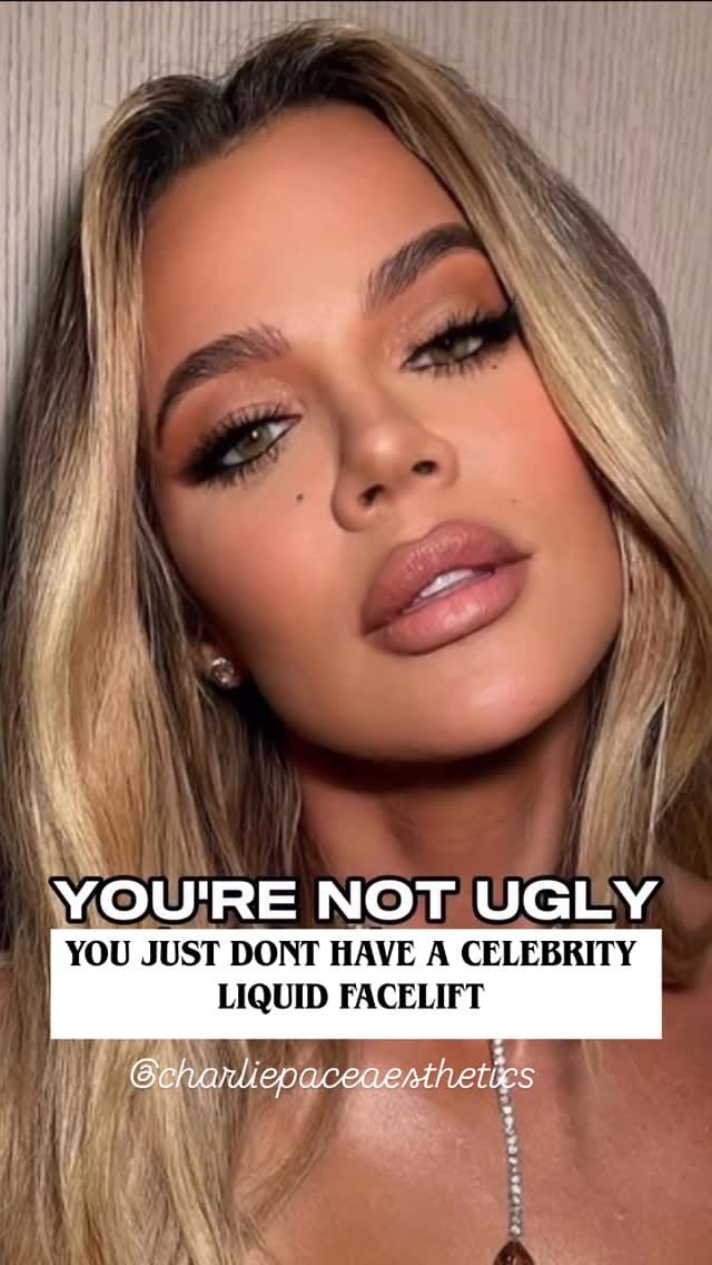 Post 9 by THE VOGUE CLINIC | AESTHETICS | LONDON • ESSEX •HERTS on Instagram (video)