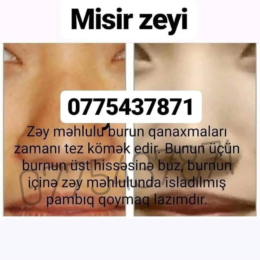 Post 6 by zey satisi official sumqayit on Instagram (image)