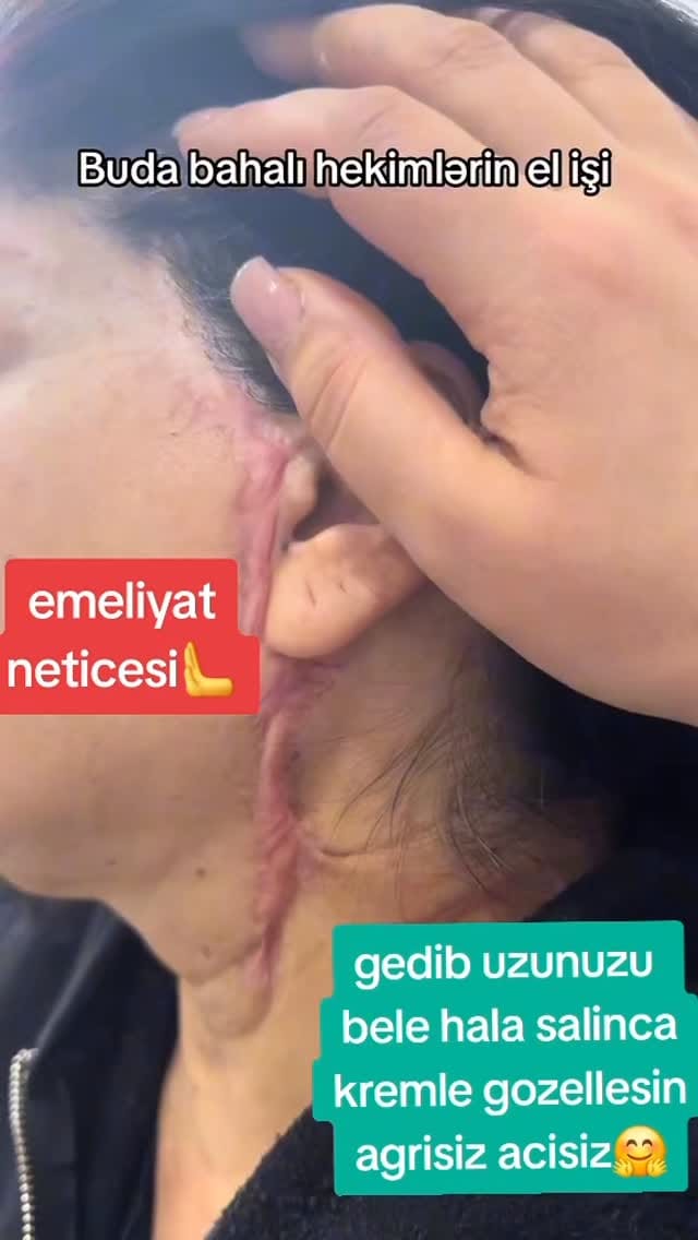 Post 9 by zey satisi official sumqayit on Instagram (video)