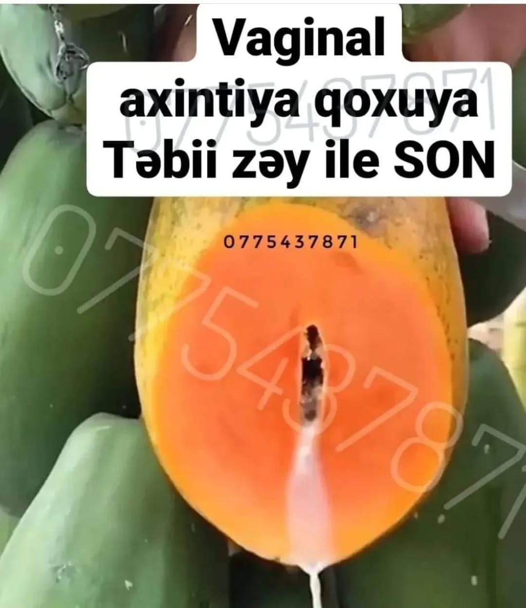 Post 2 by zey satisi official sumqayit on Instagram (image)