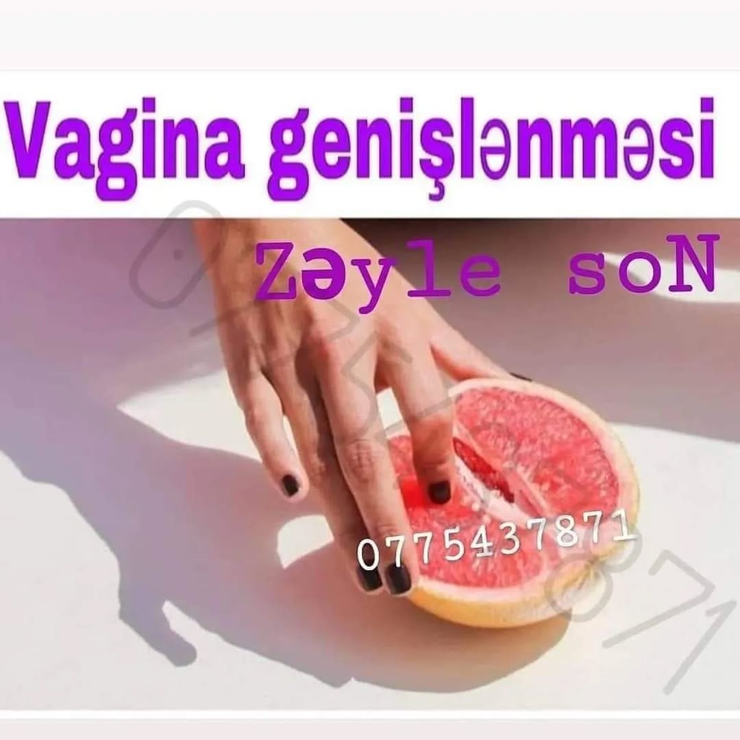 Post 5 by zey satisi official sumqayit on Instagram (image)