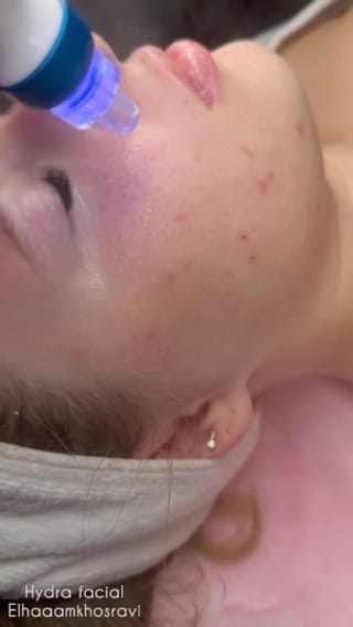 Post 4 by Elham Khosravi on Instagram (video)