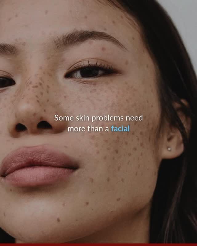 Post 1 by Tender Skin International | Skin & Hair Clinic on Instagram (video)