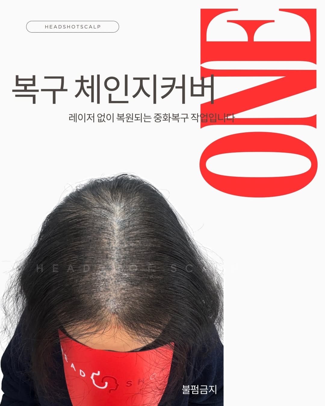 Post 3 by 두피문신 SMP수강 헤드샷스칼프본점 강남두피문신 분당두피문신 on Instagram (carousel)