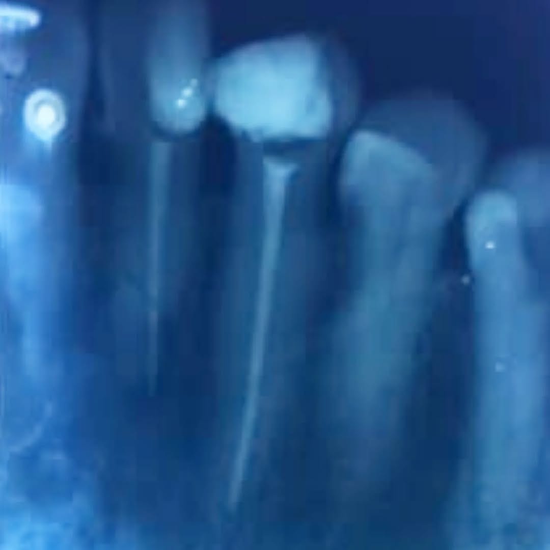 Post 1 by Tooth doctor 😁🦷 on Instagram (carousel)