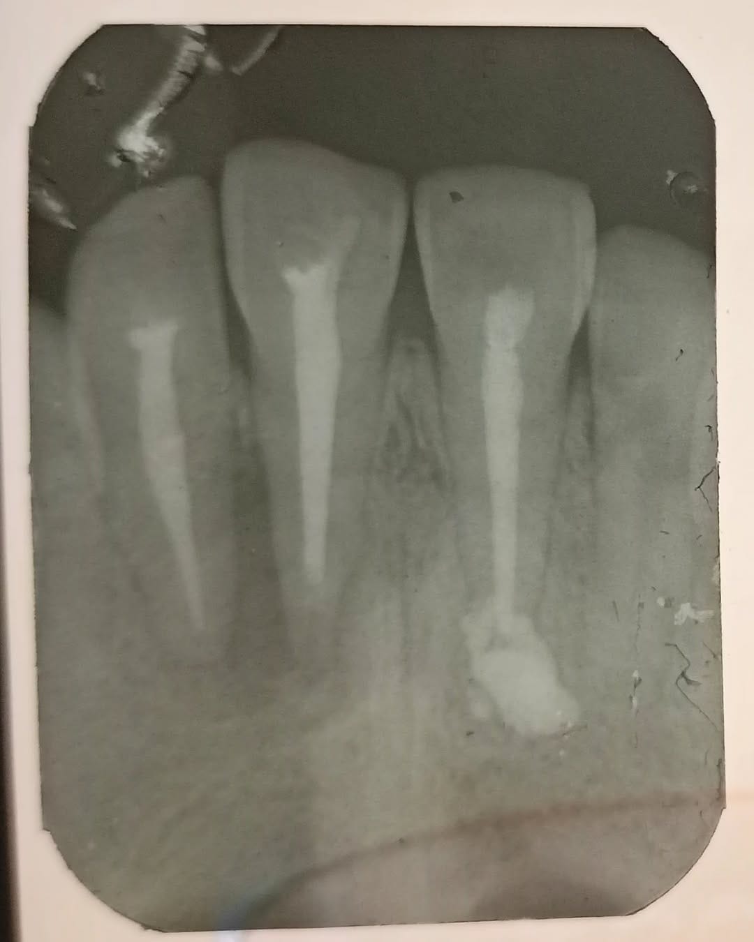 Post 2 by Tooth doctor 😁🦷 on Instagram (image)
