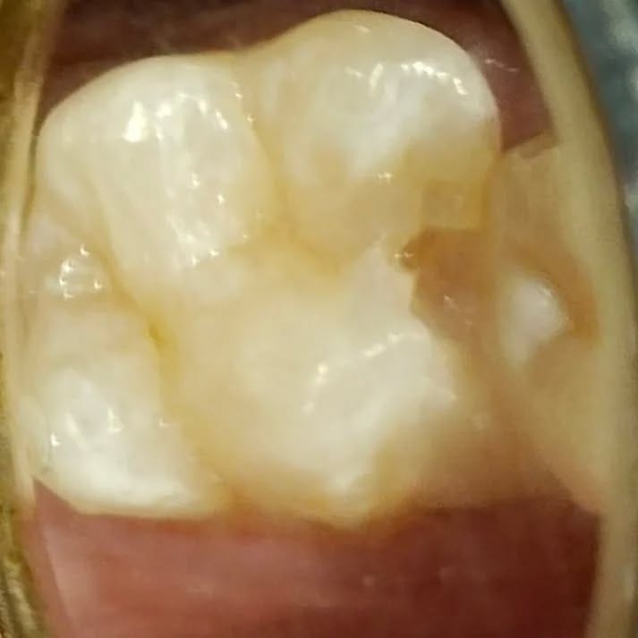 Post 8 by Tooth doctor 😁🦷 on Instagram (carousel)