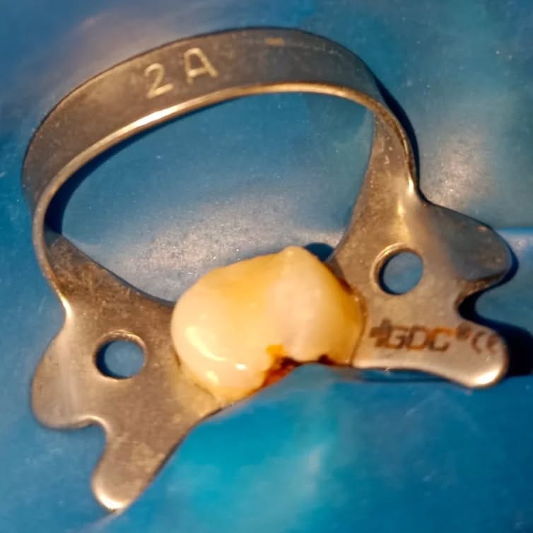 Post 10 by Tooth doctor 😁🦷 on Instagram (carousel)