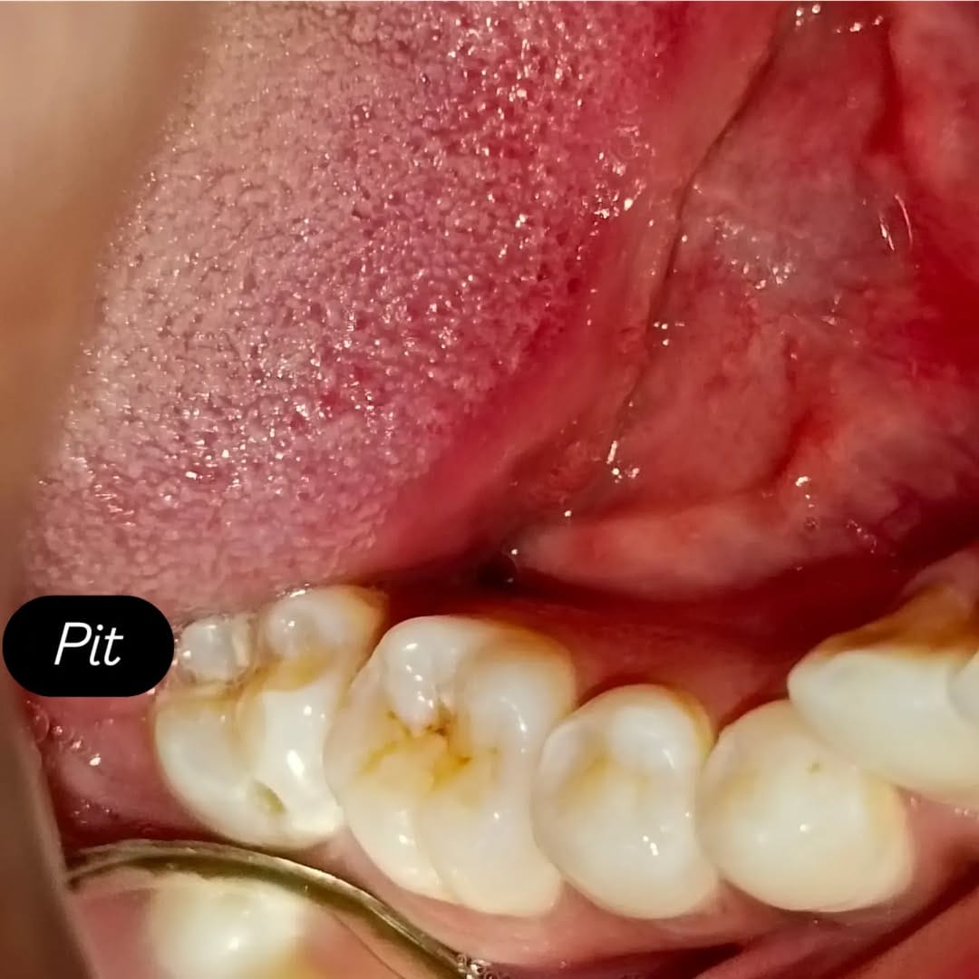Post 4 by Tooth doctor 😁🦷 on Instagram (carousel)