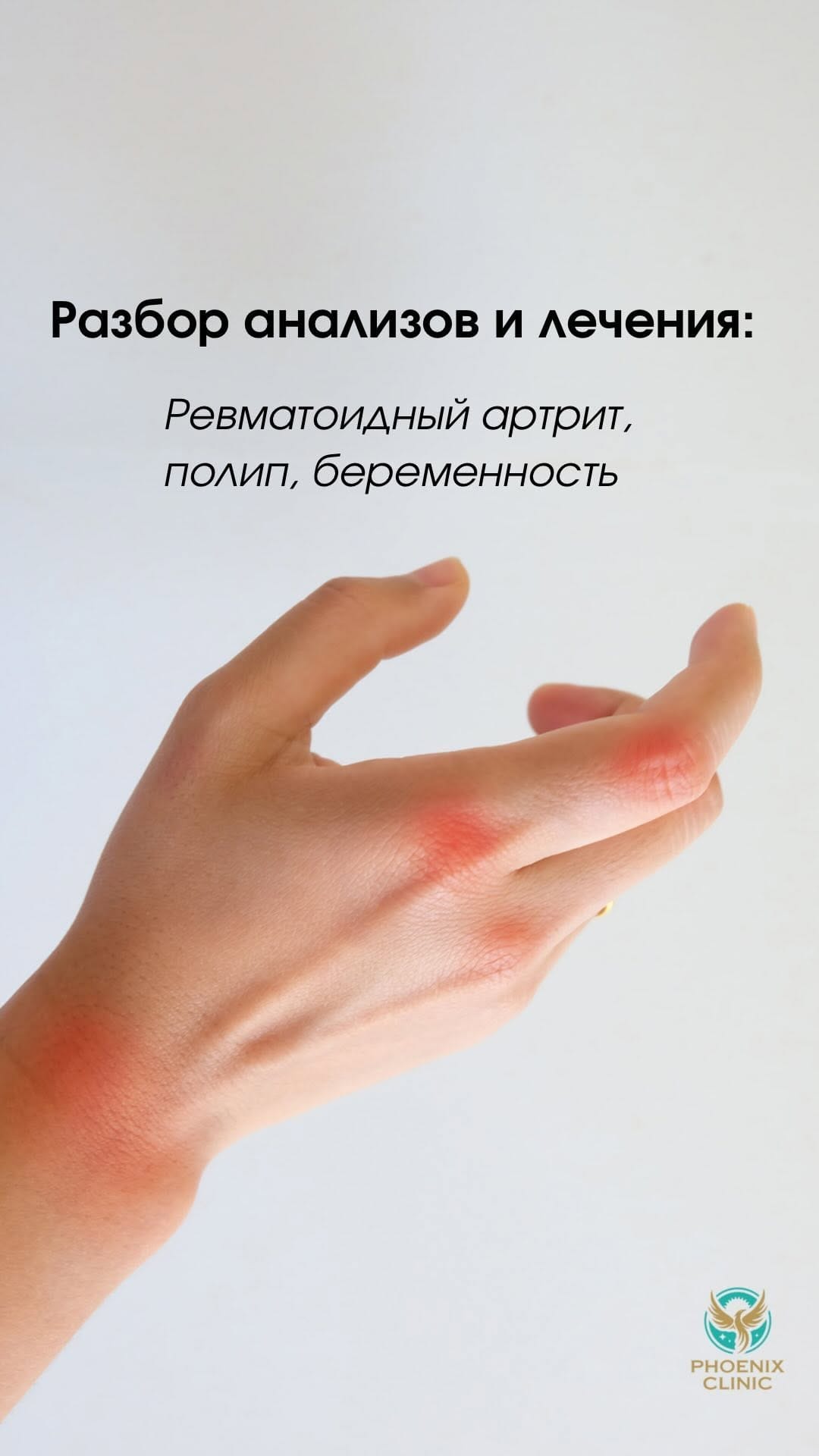 Post 10 by ТЕРАПЕВТ - ДИЕТОЛОГ, НУТРИЦИОЛОГ on Instagram (video)