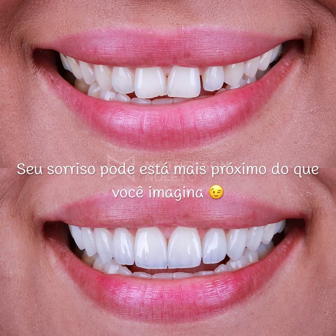 Post 2 by Matherson Ariel Nogueira Noleto on Instagram (image)