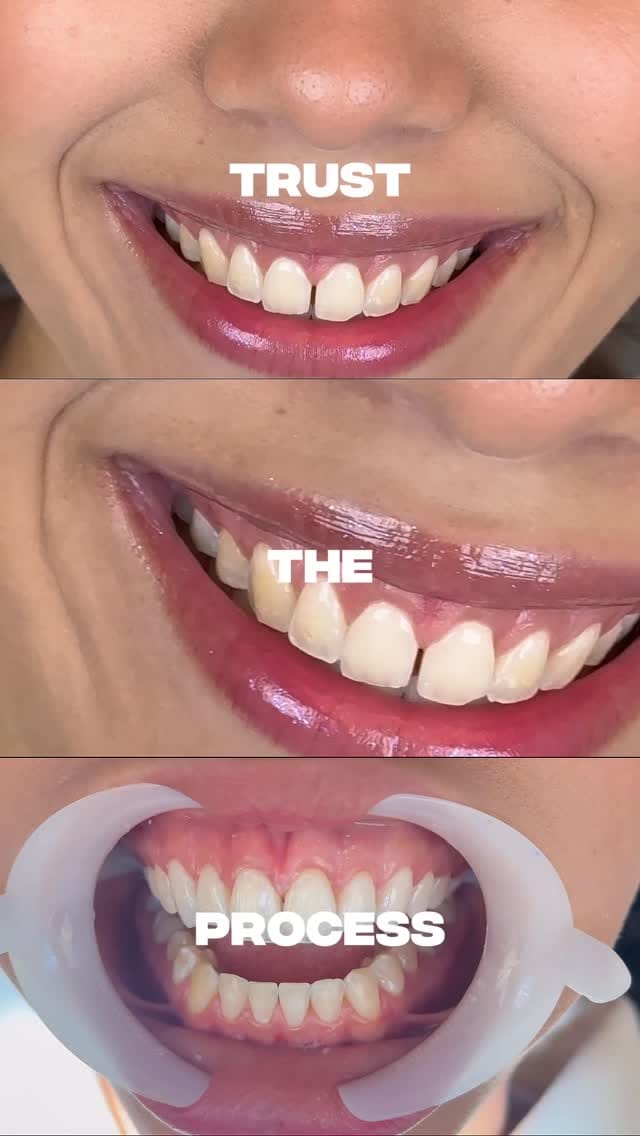 Post 5 by Matherson Ariel Nogueira Noleto on Instagram (video)