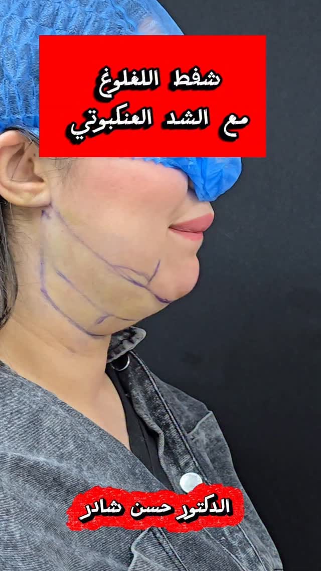 Post 5 by Dr Chader Hassan  د. حسن شادر on Instagram (video)