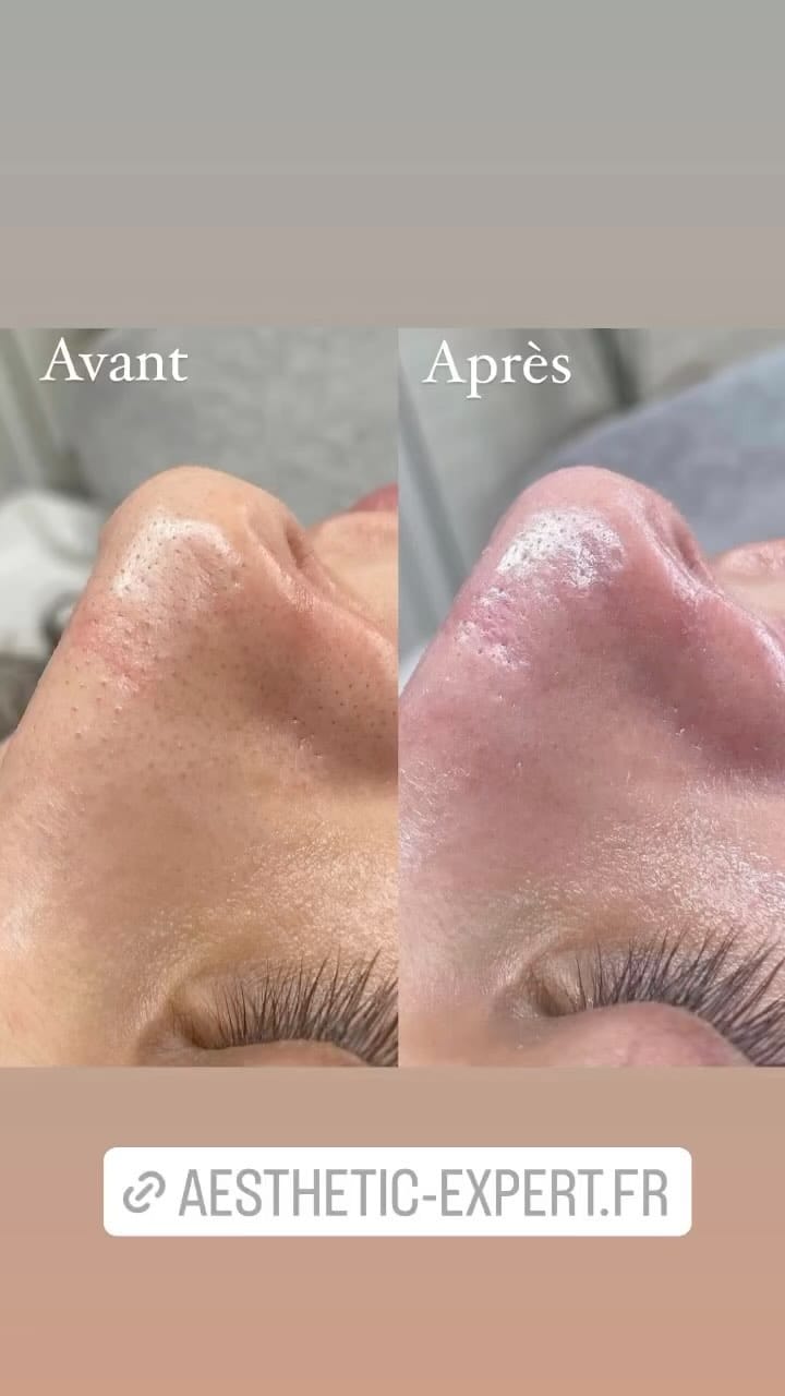 Post 1 by Centre esthetique Toulon on Instagram (video)