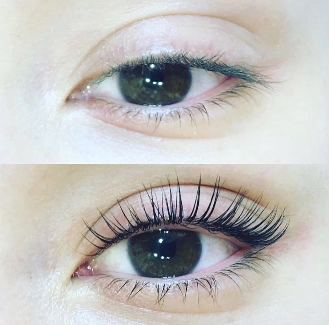 Post 6 by Centre esthetique Toulon on Instagram (image)