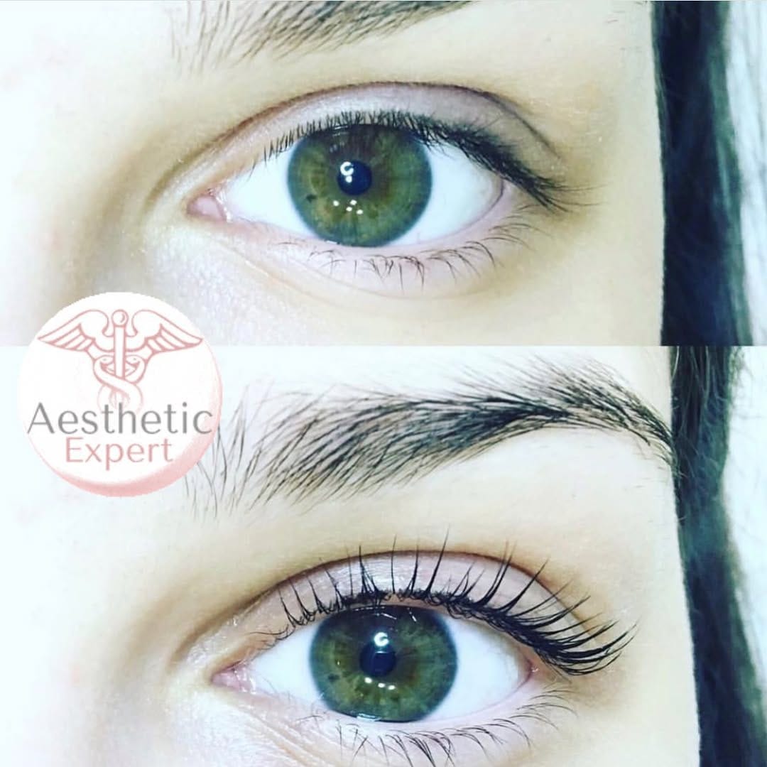 Post 4 by Centre esthetique Toulon on Instagram (image)