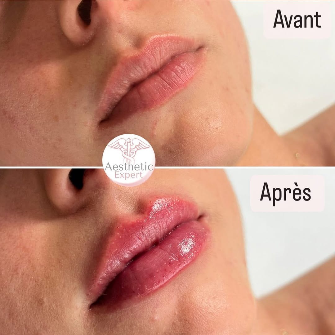 Post 10 by Centre esthetique Toulon on Instagram (image)