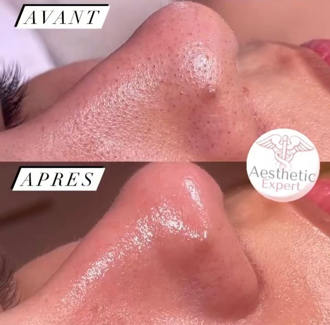 Post 9 by Centre esthetique Toulon on Instagram (image)