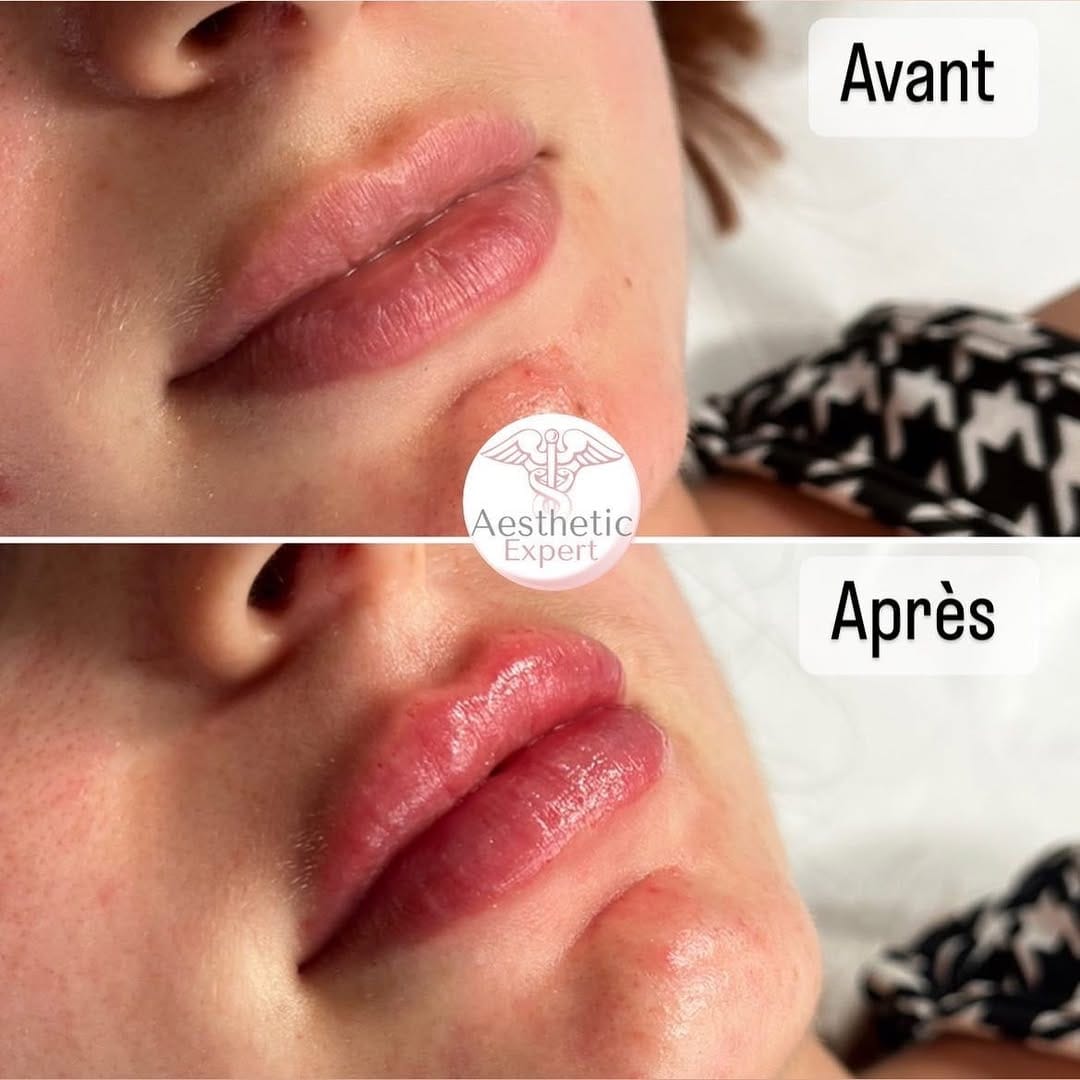 Post 8 by Centre esthetique Toulon on Instagram (image)