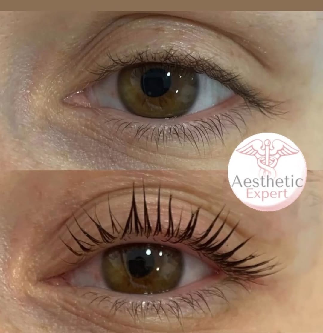Post 5 by Centre esthetique Toulon on Instagram (image)