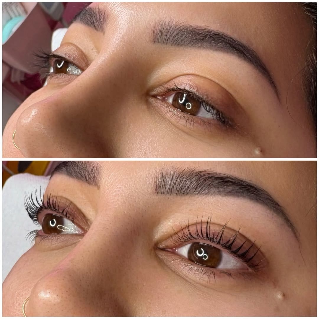 Post 7 by Luxury Beauty and Aesthetics on Instagram (image)