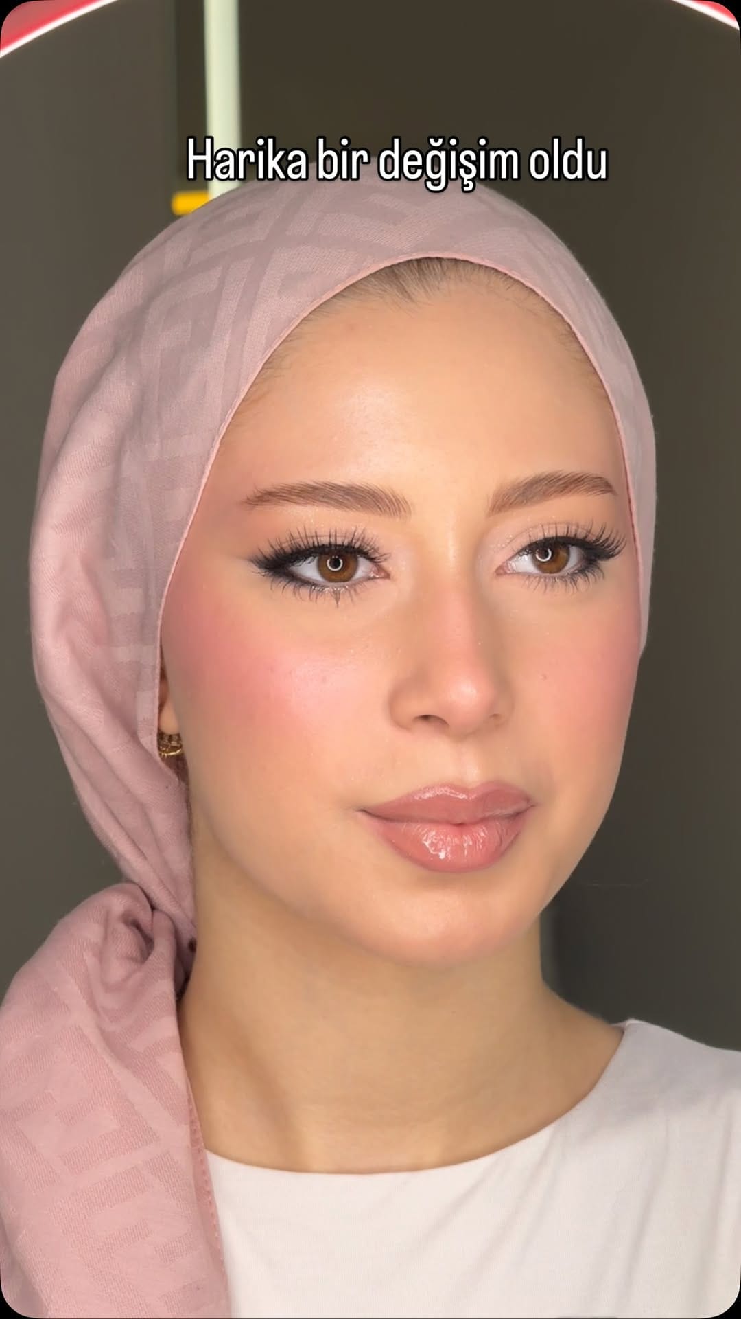 Post 1 by Dilamed Ümraniye on Instagram (video)