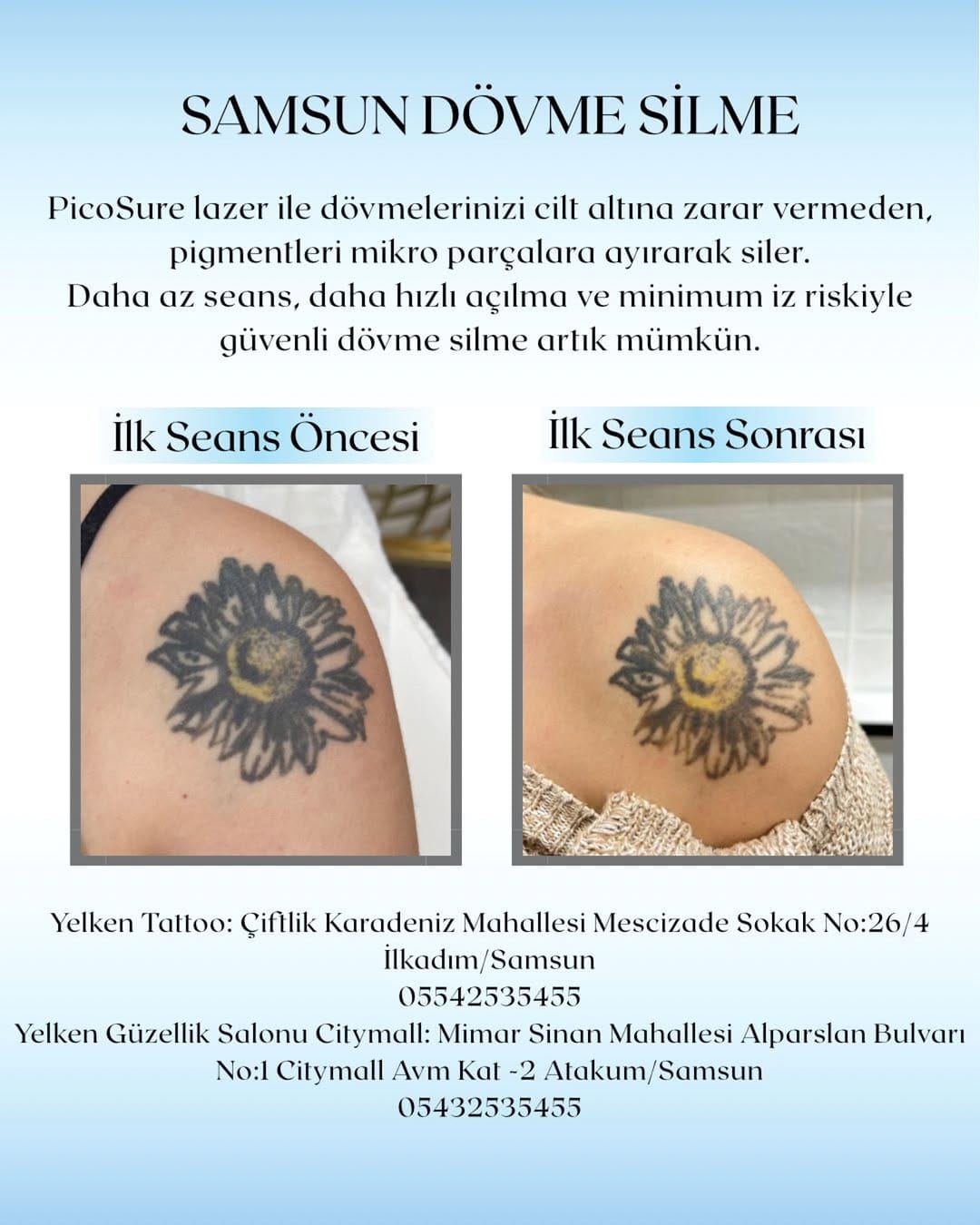 Post 6 by Baris Tattoo on Instagram (image)
