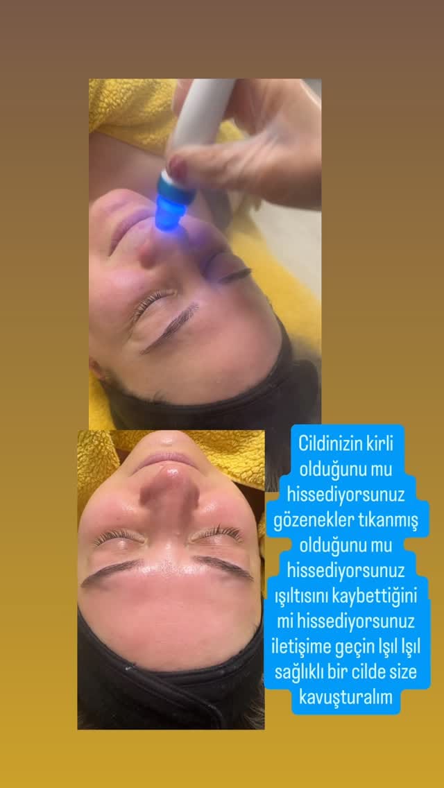 Post 7 by Kiraz Kosmetik on Instagram (video)