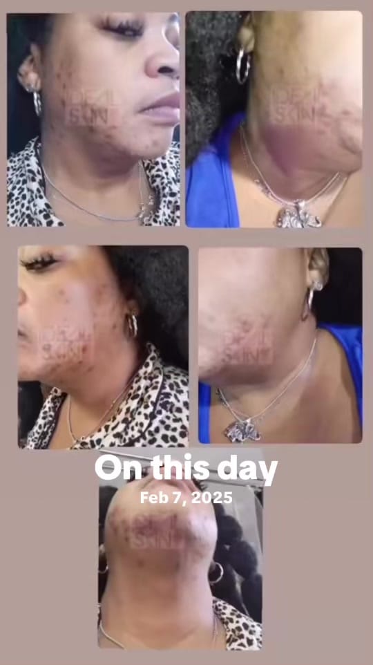 Post 9 by Idealskinllc on TikTok (video)