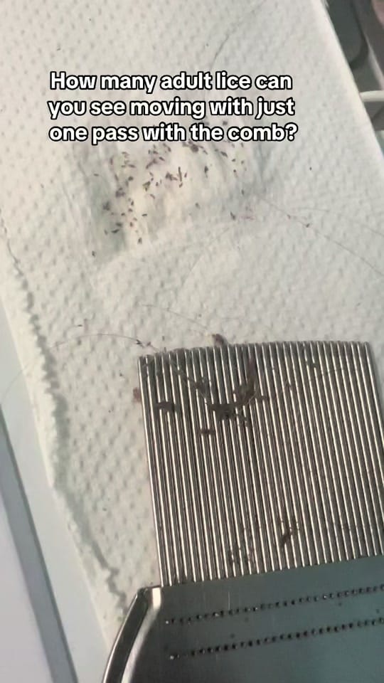 Post 3 by The Lice Goddess on TikTok (video)