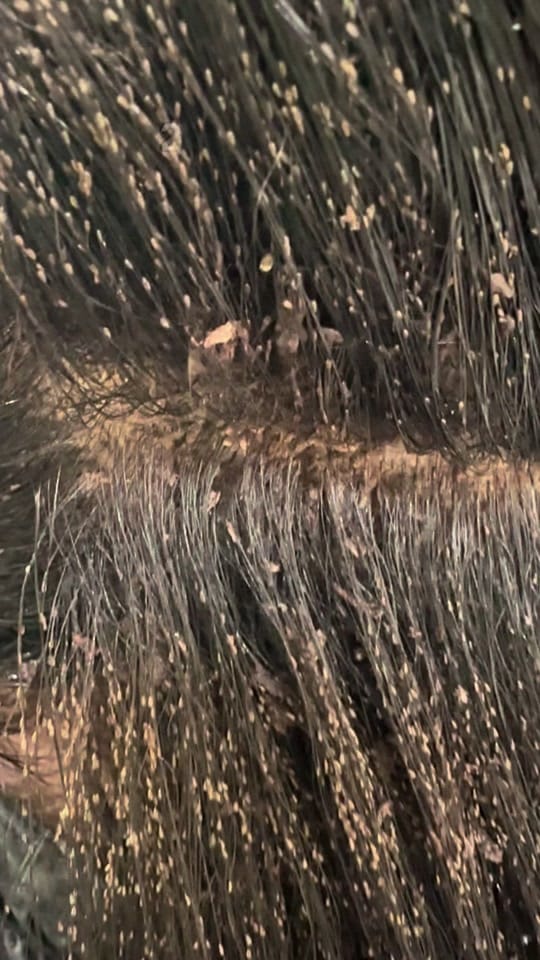 Post 9 by The Lice Goddess on TikTok (video)