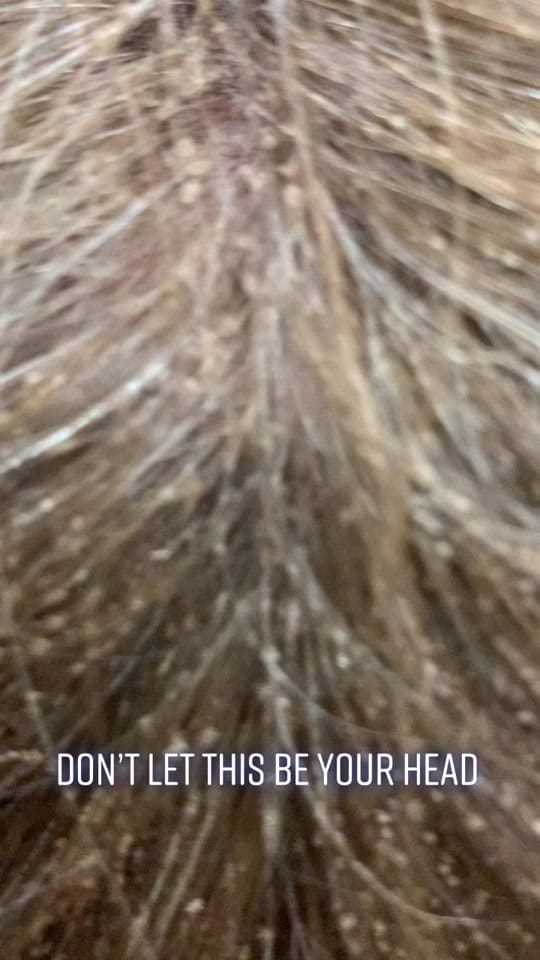 Post 10 by The Lice Goddess on TikTok (video)