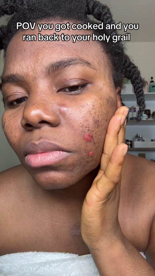 Post 5 by Hope’s beauty junkies 🇺🇸🇳🇬 on TikTok (video)