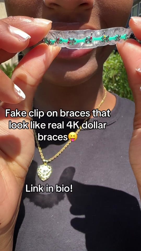 Post 9 by Glowani | clip-on braces guru on TikTok (video)