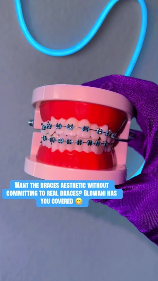 Post 2 by Glowani | clip-on braces guru on TikTok (video)