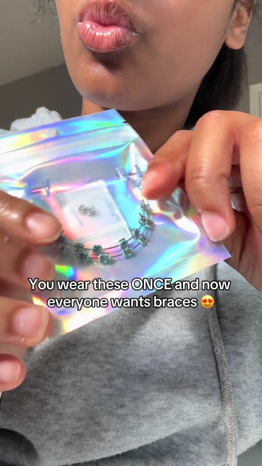 Post 10 by Glowani | clip-on braces guru on TikTok (video)