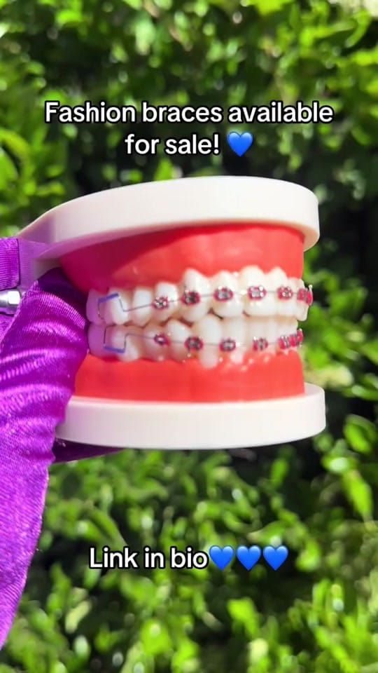 Post 4 by Glowani | clip-on braces guru on TikTok (video)