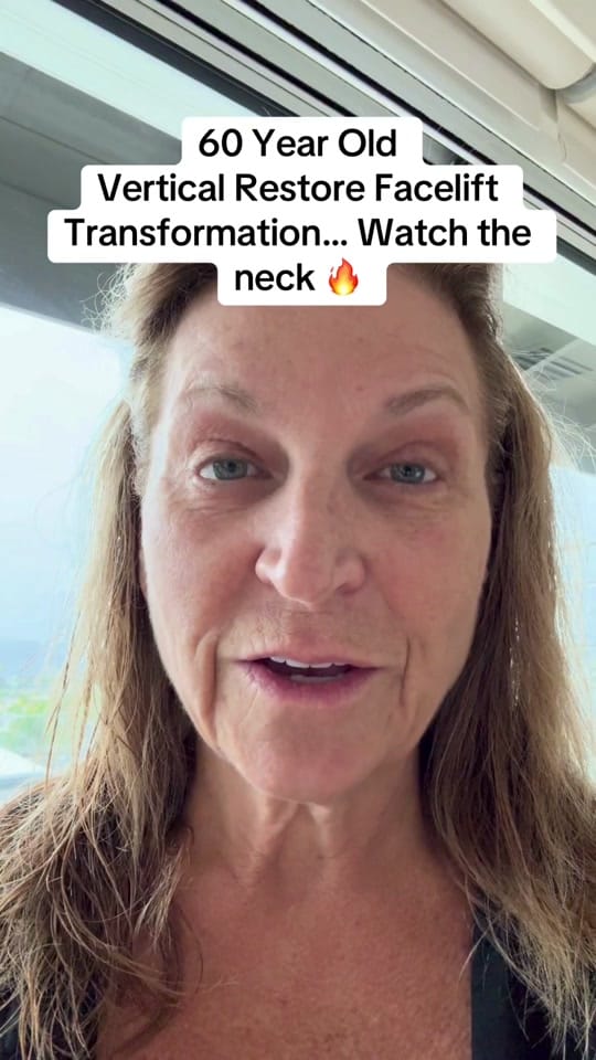 Post 2 by Dramirkaram on TikTok (video)