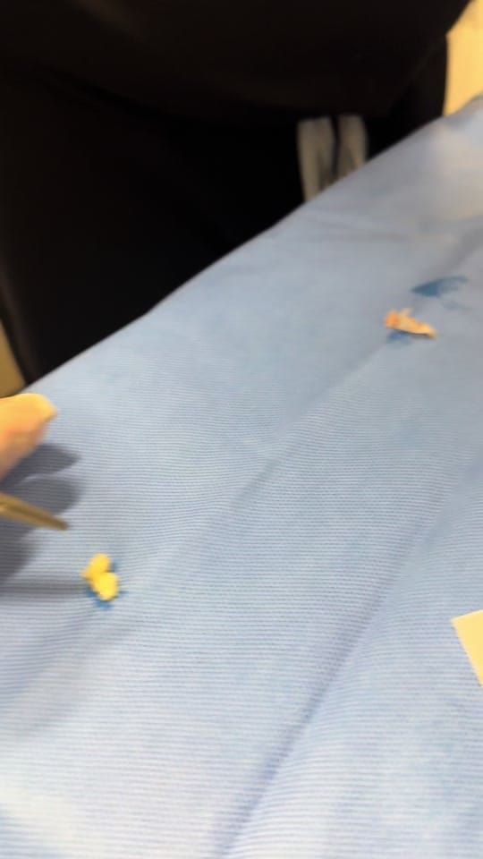 Post 8 by Austin Plastic Surgery on TikTok (video)
