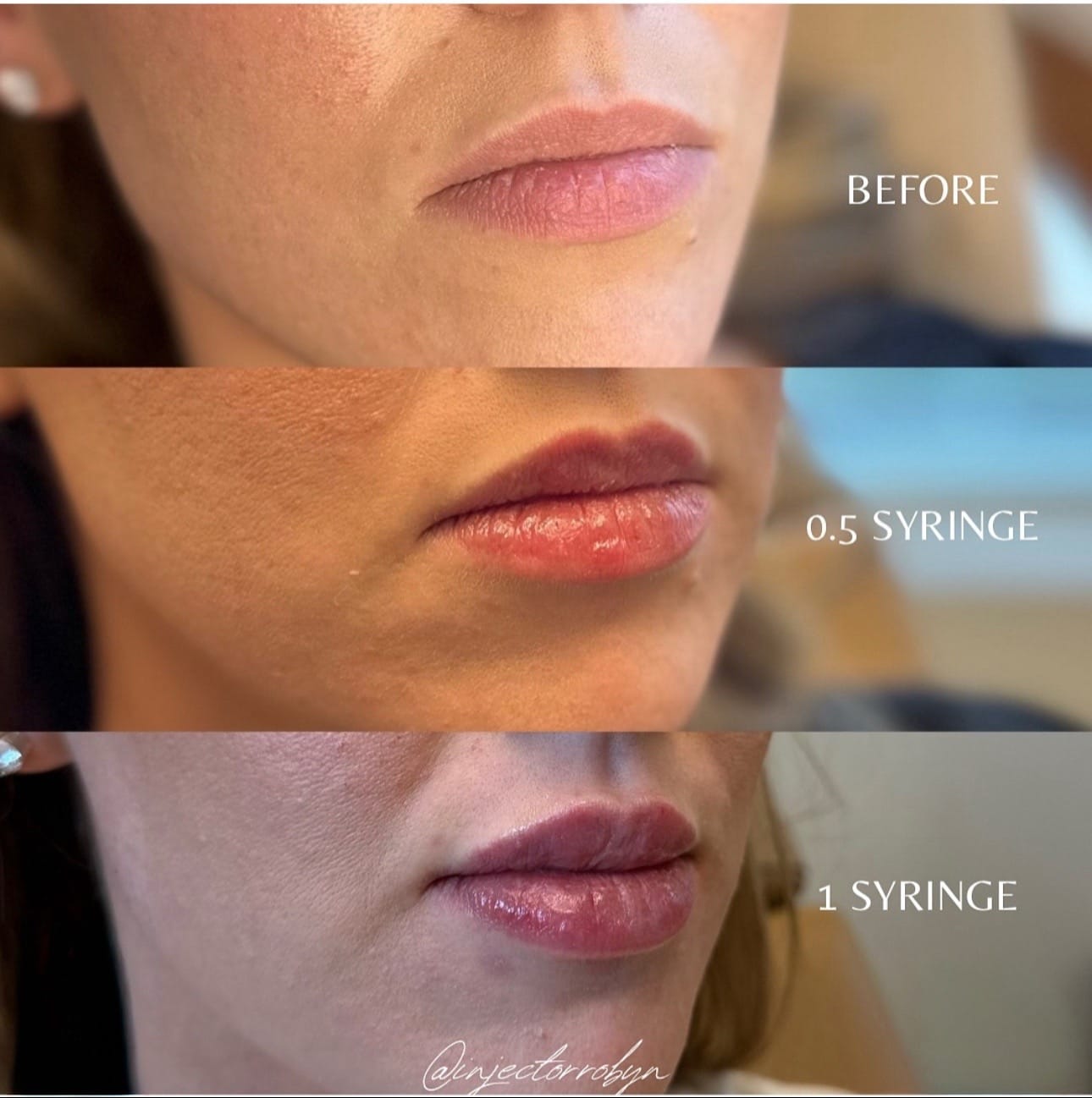 Post 3 by Austin Plastic Surgery on TikTok (video)