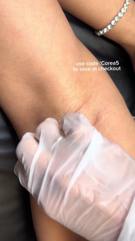 Post 1 by COREA🩷 | DALLAS ESTHETICIAN on TikTok (video)