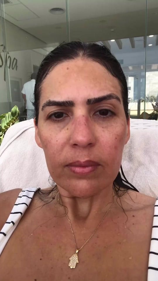 Post 10 by Sarit | Melasma Expert on TikTok (video)