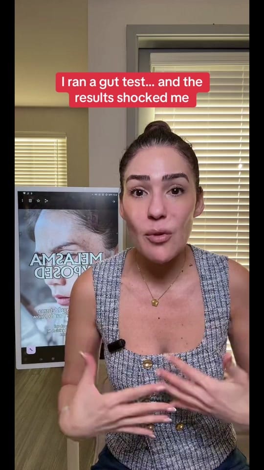 Post 1 by Sarit | Melasma Expert on TikTok (video)